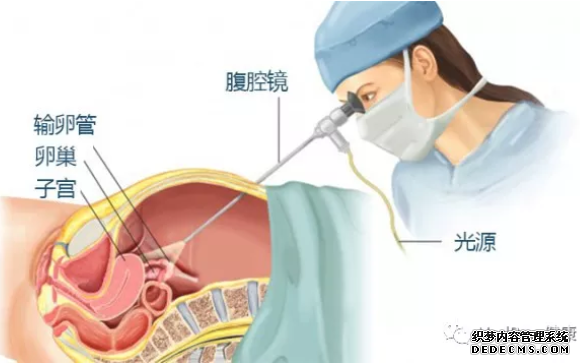 泰安新闻聚焦-患上宫外孕会有哪些症状
